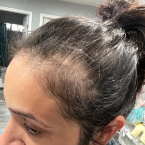 Update 164+ streax hair serum review super hot